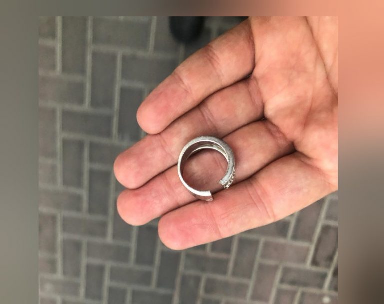 הטבעת נתקעה באצבע של האישה מחדרה – זה מה שהיא עשתה